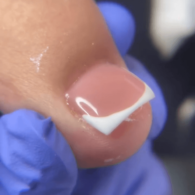 Desirable Toes ( Reconstruction ) 