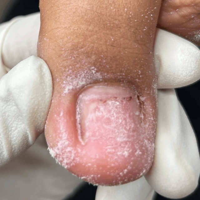 Desirable Toes & Soles Treatment 